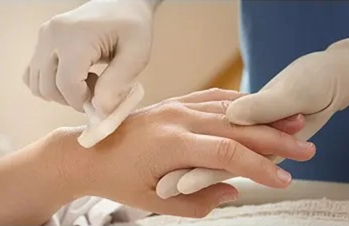 Sepsis: 11 millones de muertes al año destacan la importancia de prevenir infecciones
